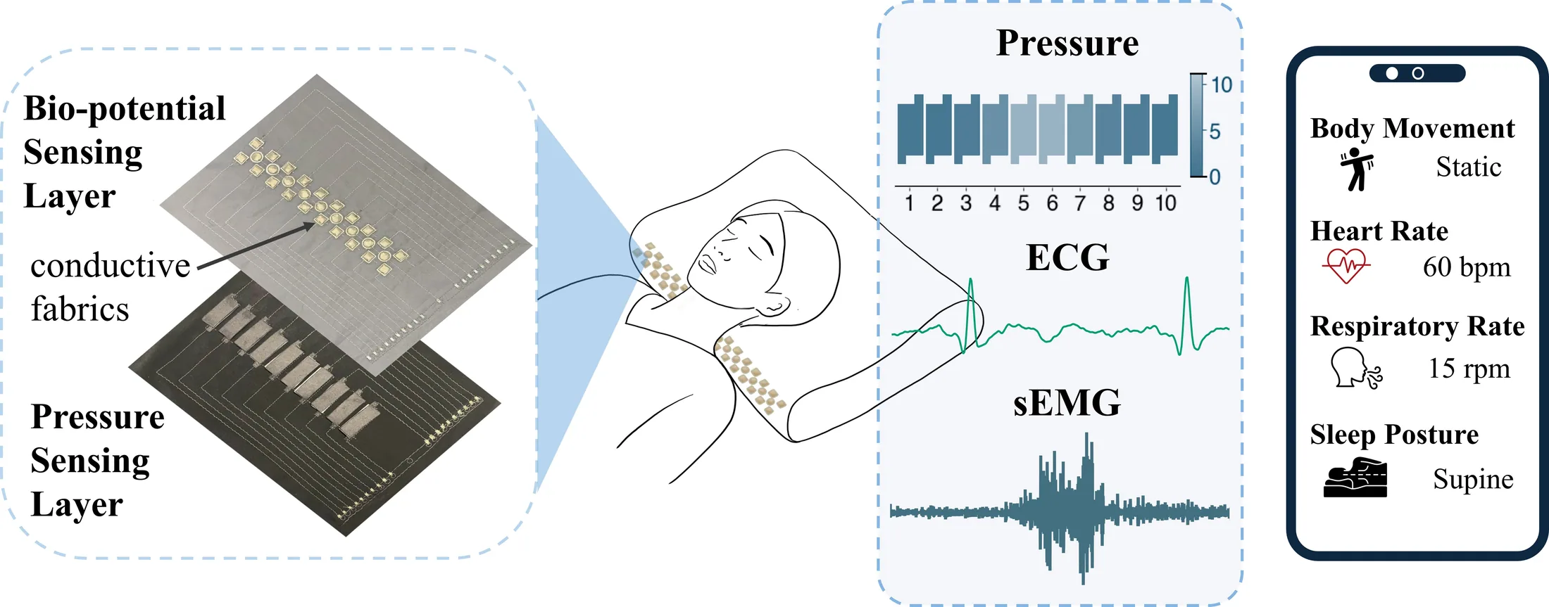 My Pillow Knows My Sleep: Sleep Monitoring with Computational Fabrics in the Pillowcase